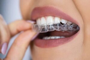 Union Street Dental Centre